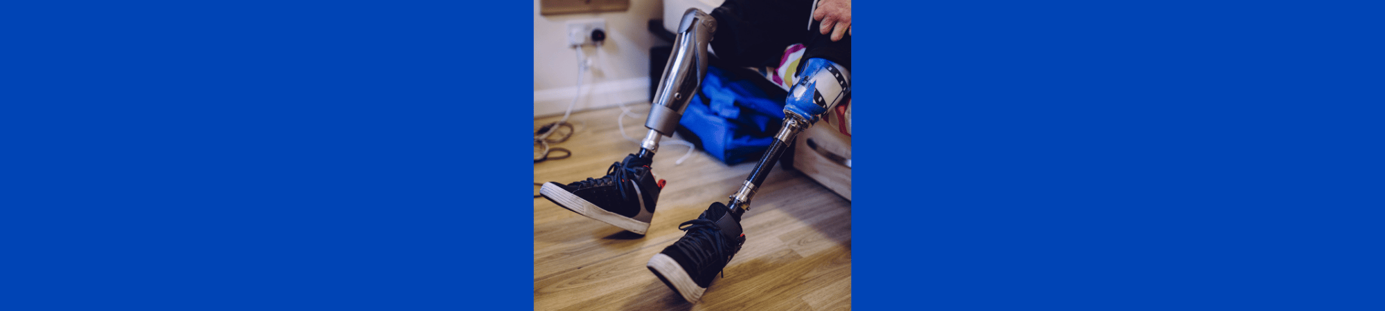 man with two prosthetic legs sitting on bed